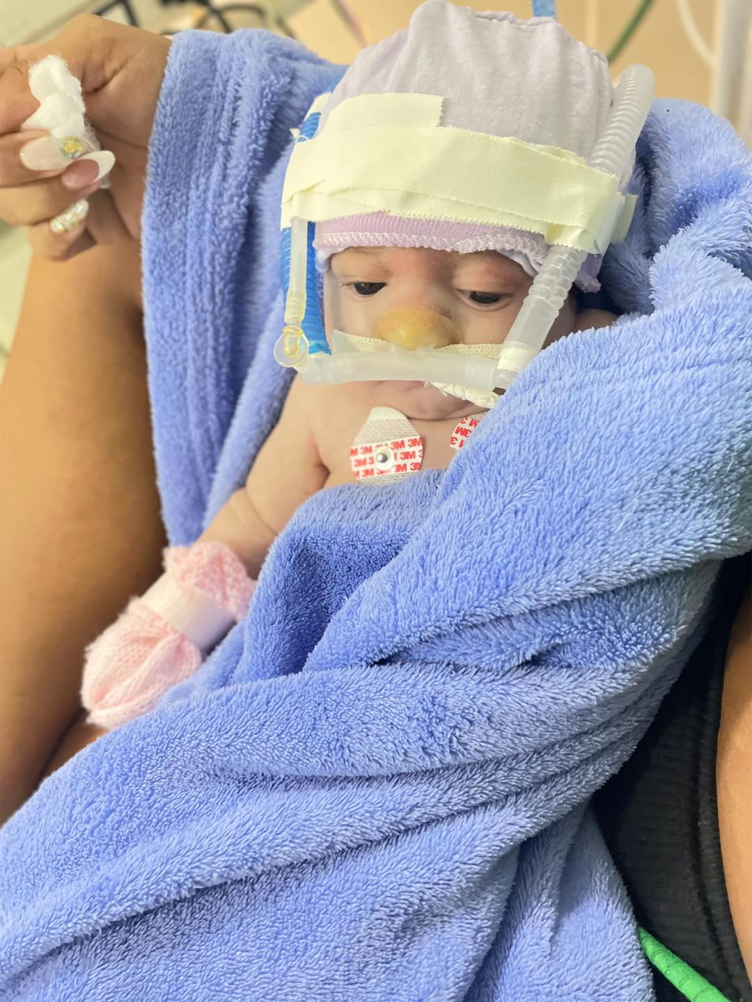 Stella - criança que precisa de ajuda médica urgente